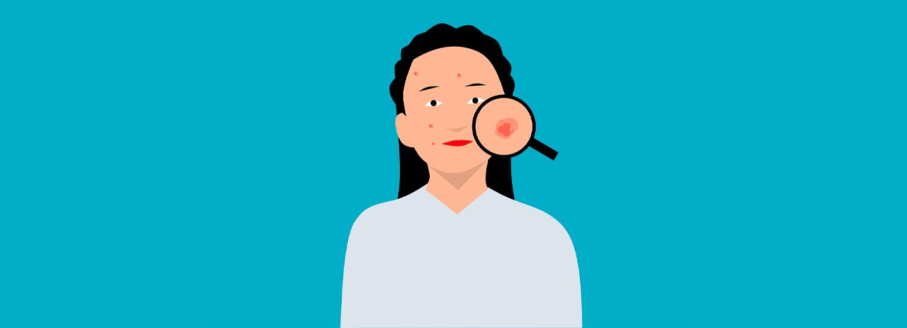 is sauna bad for acne